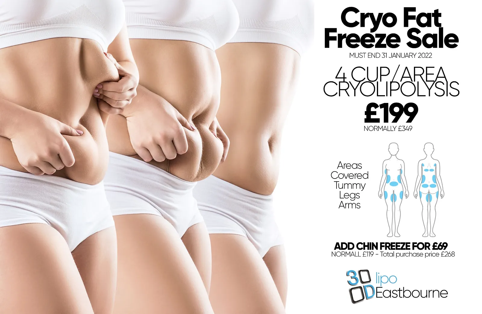 Fat Freeze Eastbourne Cryolipolysis